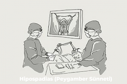 Hipospadias (Peygamber Sünneti) Nedir? Nasıl Tedavi Edilir?
